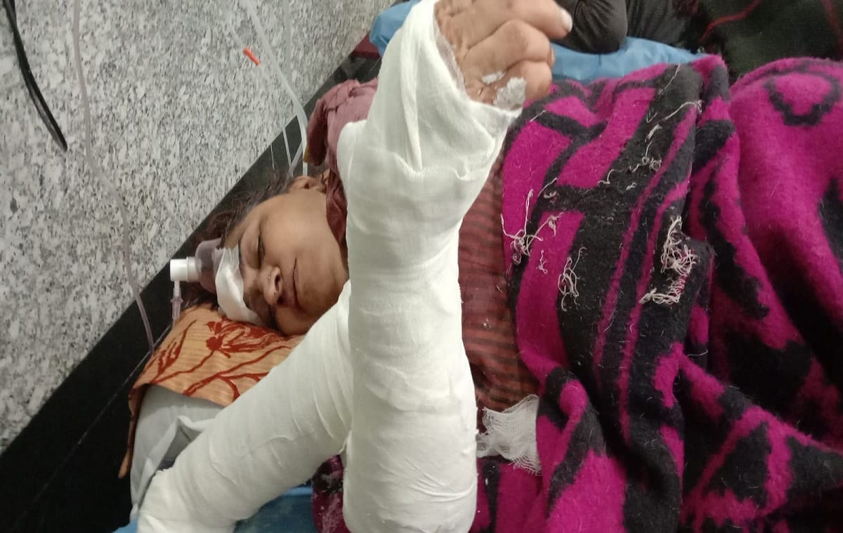 Woman leader of BJP Mahanagar injured after falling from roof of house in varanasi