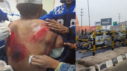 Indian Cricketer Mercedes Collided With Divider On Delhi Dehradun Highway Know Health Updates
