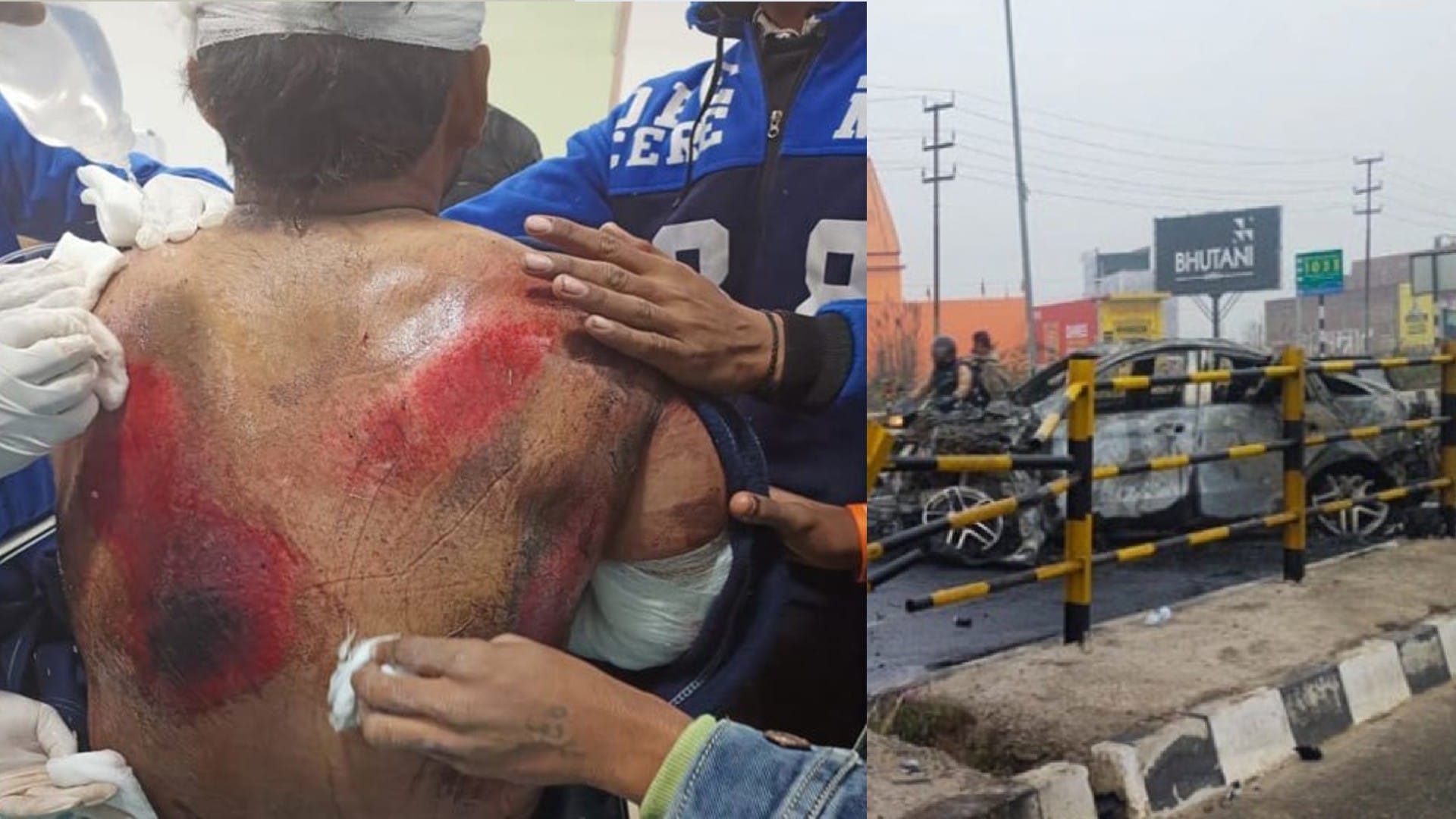 Rishabh Pant Accident BMW Car accident in Roorkee News in Hindi