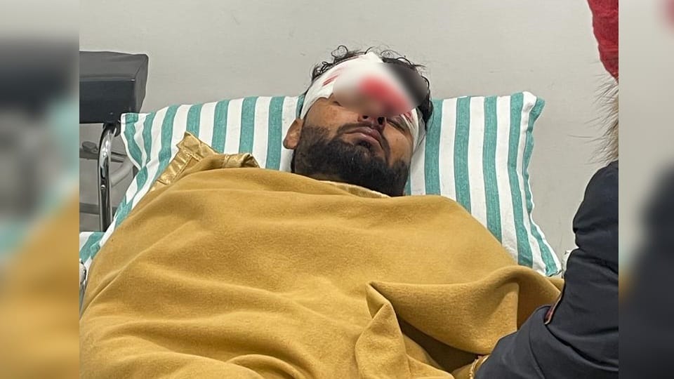 Cricketer Rishabh Pant Car Horrible Accident in roorkee Photos