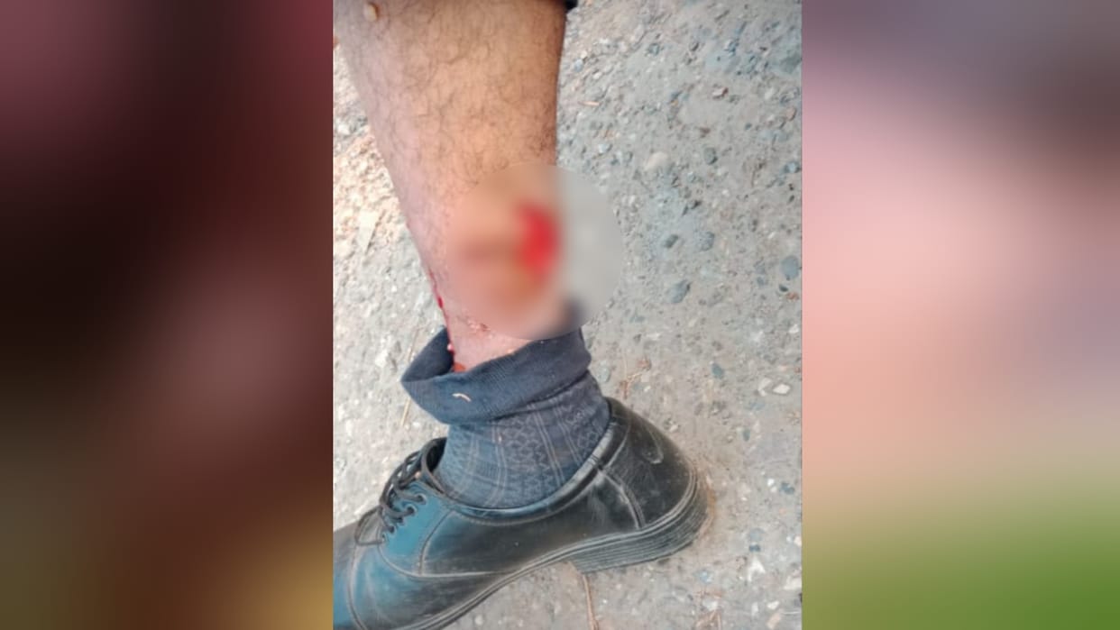 Guard bitten by dog after searching suspicious bag in noida