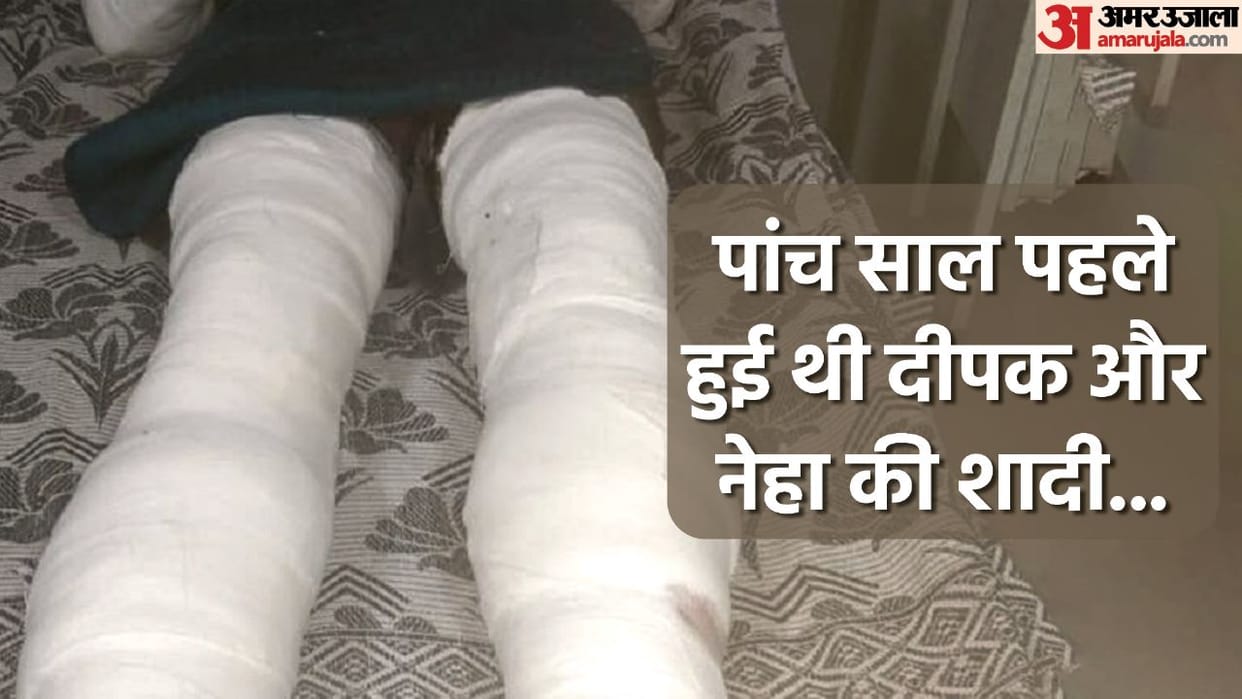 Wife hangs herself from fan in Noida husband both legs are broken