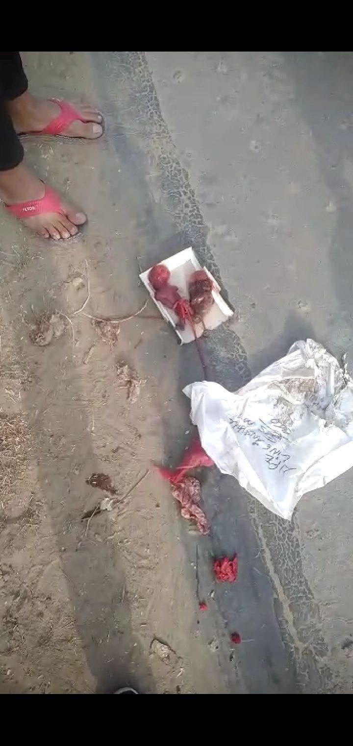 Shame on humanity... two mutilated fetuses found in a sweet box on the canal bridge near the police block