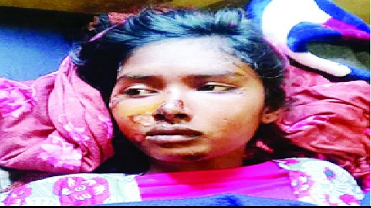 Delhi-like Incident In Kaushambi, Girl Student Dragged 300 Meters After Getting Stuck In A Car