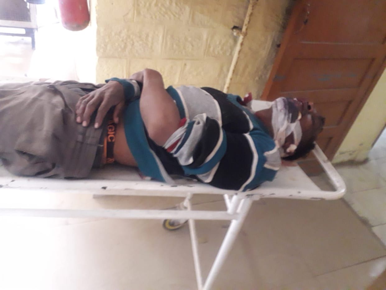 Migrant youth fell from the bridge after slipping his foot