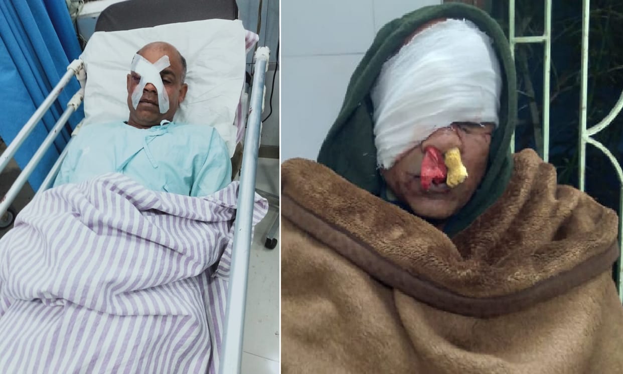 West Bengal: Smugglers attack BSF team on Bangladesh border, four jawans including a woman injured