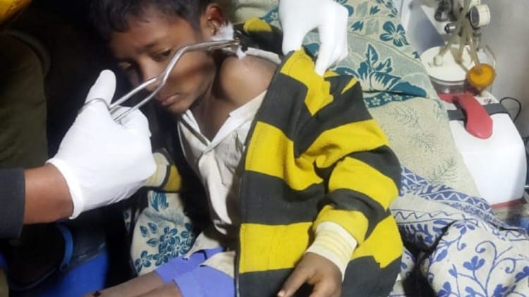 सियार के हमले में घायल बच्चा।