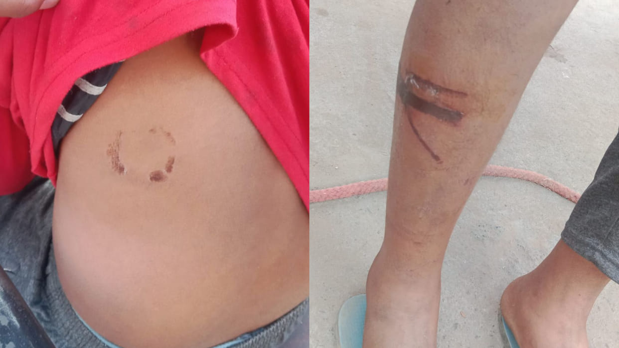 Teen tortured in hotel in Bhiwani of Haryan