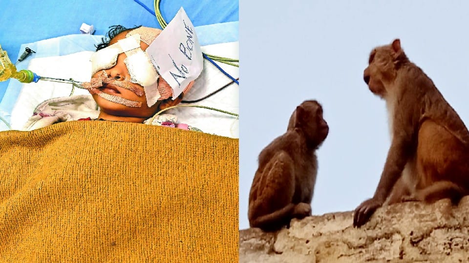 two year old child injured after monkeys tore down boundary wall in bareilly