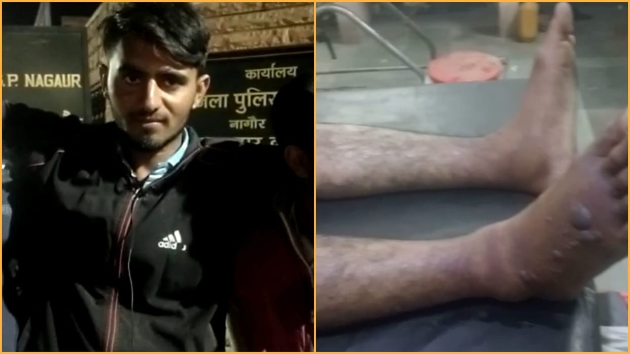 Accused of assaulting a young man in police custody in Nagaur