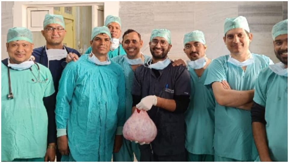 15 kg lump removed from stomach of an elderly woman in Jaipur SMS Hospital