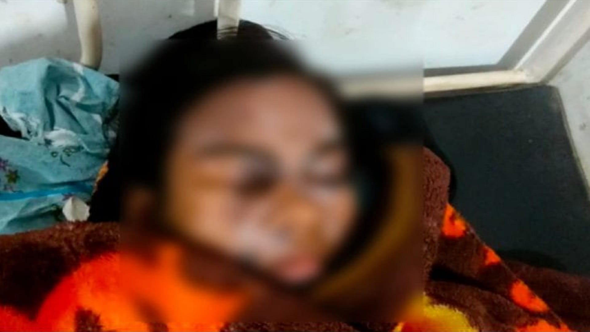 girl students scorched due to acid spill in government school in sakti