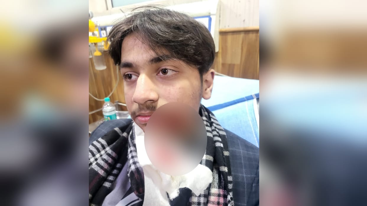 BJP leader son comes to the grip of Chinese manjha in Meerut, got 20 stitches on his face