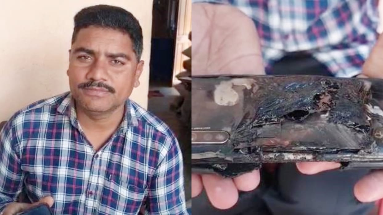 MP News Mobile battery kept in pocket of the youth pants suddenly exploded In Khandwa