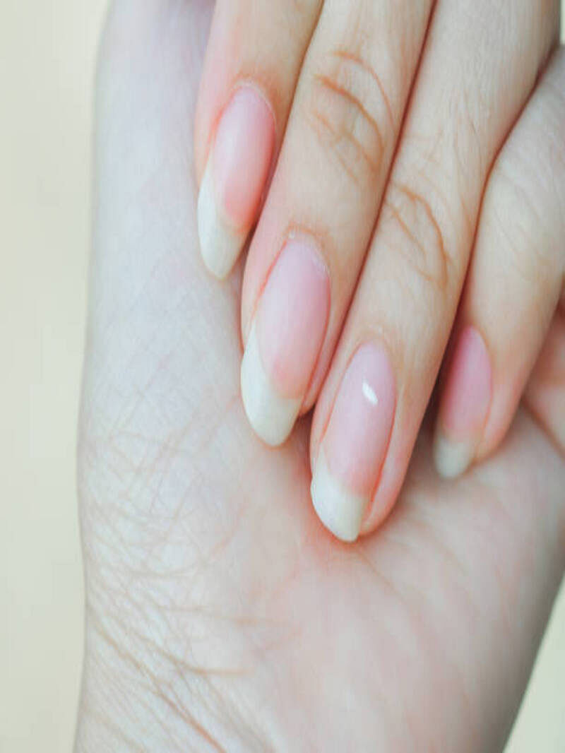 white spot on nails 1673523906