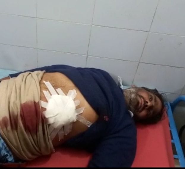 Father and son shot dead in enmity, both referred to Agra