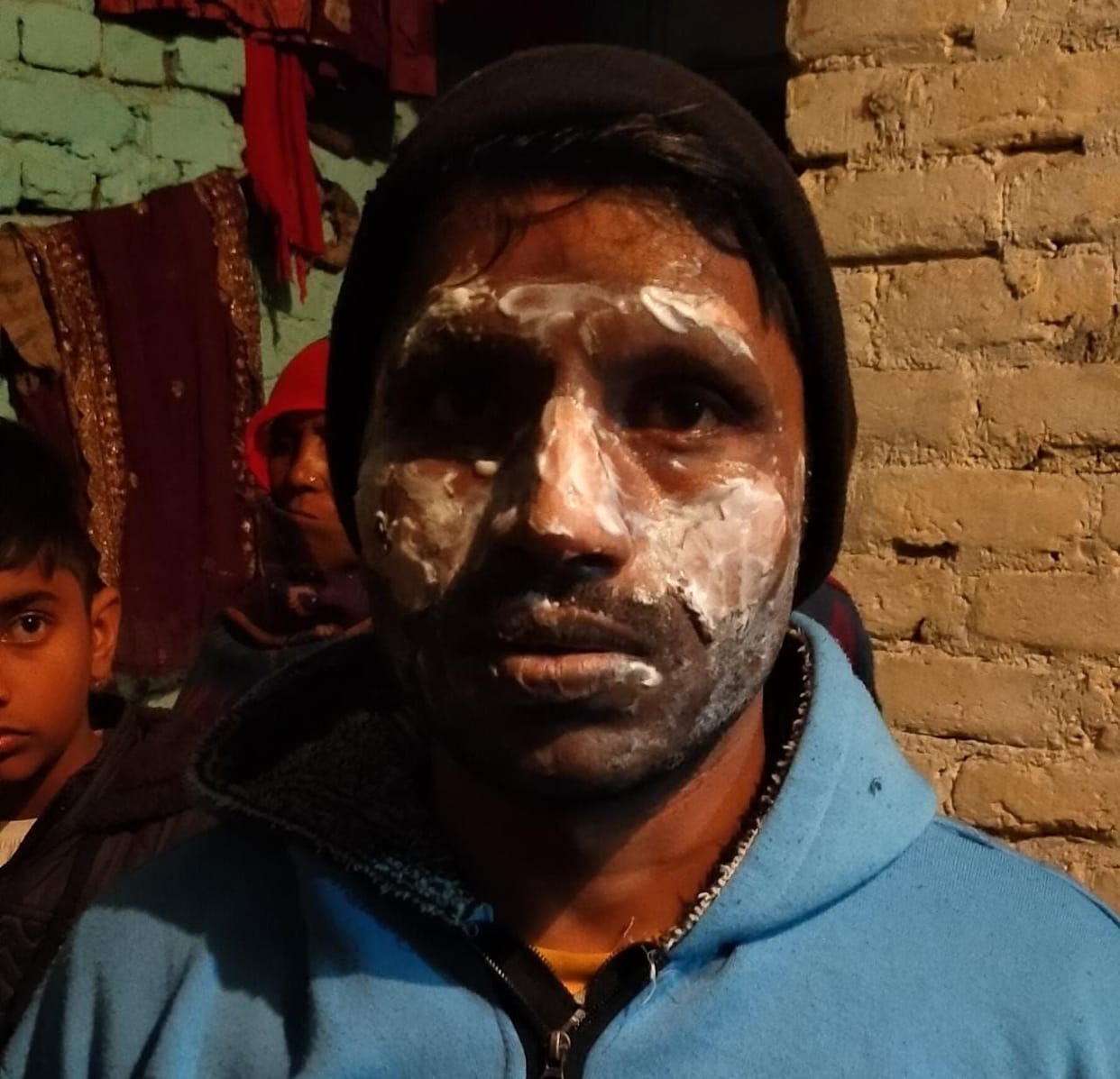 The house caught fire due to gas leaking in the cylinder, three scorched including the couple