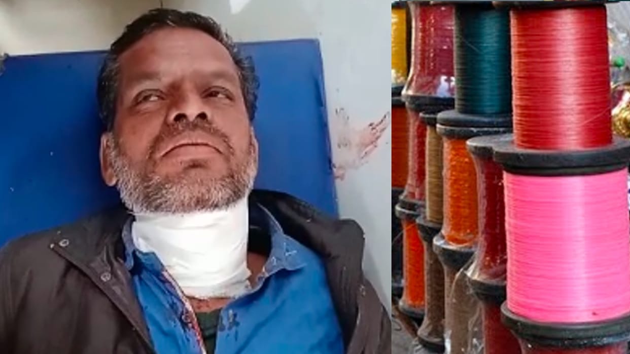 Makar Sankranti: Accidents in kite flying in Chhindwara, two people's neck and one's leg were cut