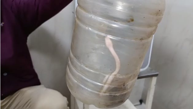 Son was bitten by a snake, the father reached the hospital by locking him in a box