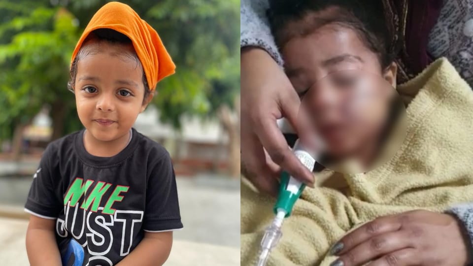 Punjab: Child came in grip of China dor in Khanna, 120 stitches on his mouth