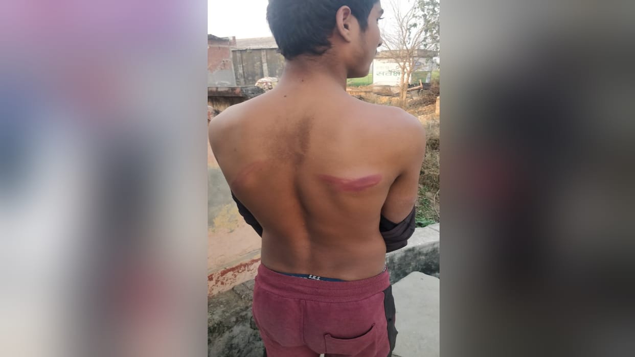 bulandshahr teachers beat badly to student by stick injured