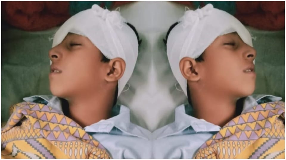 Child eye damaged due to School Teacher beating in Jaipur Cant see after two surgeries