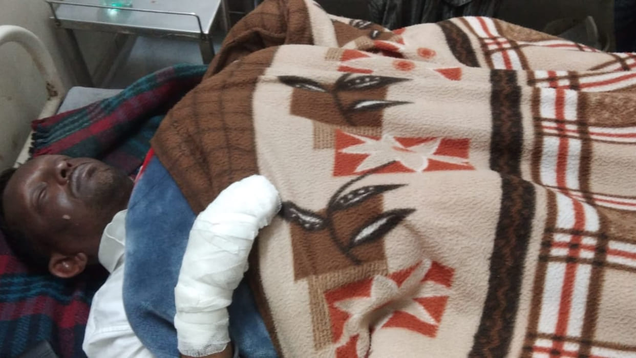 20 people got scorched due to gas cylinder explosion in birthday party in Karnal