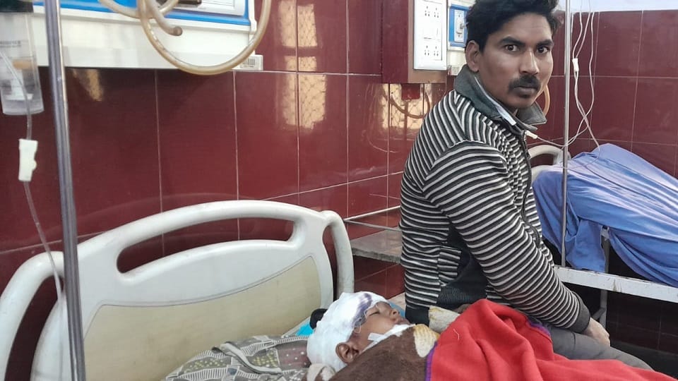 Dogs attacked a five-year-old child in Rampur 22 stitches applied on head mouth thigh