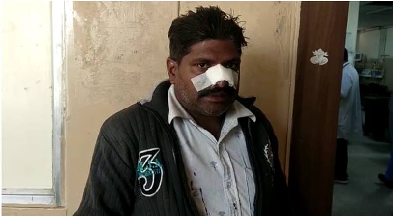 Bike rider injured by china door serious wounds in face and hand