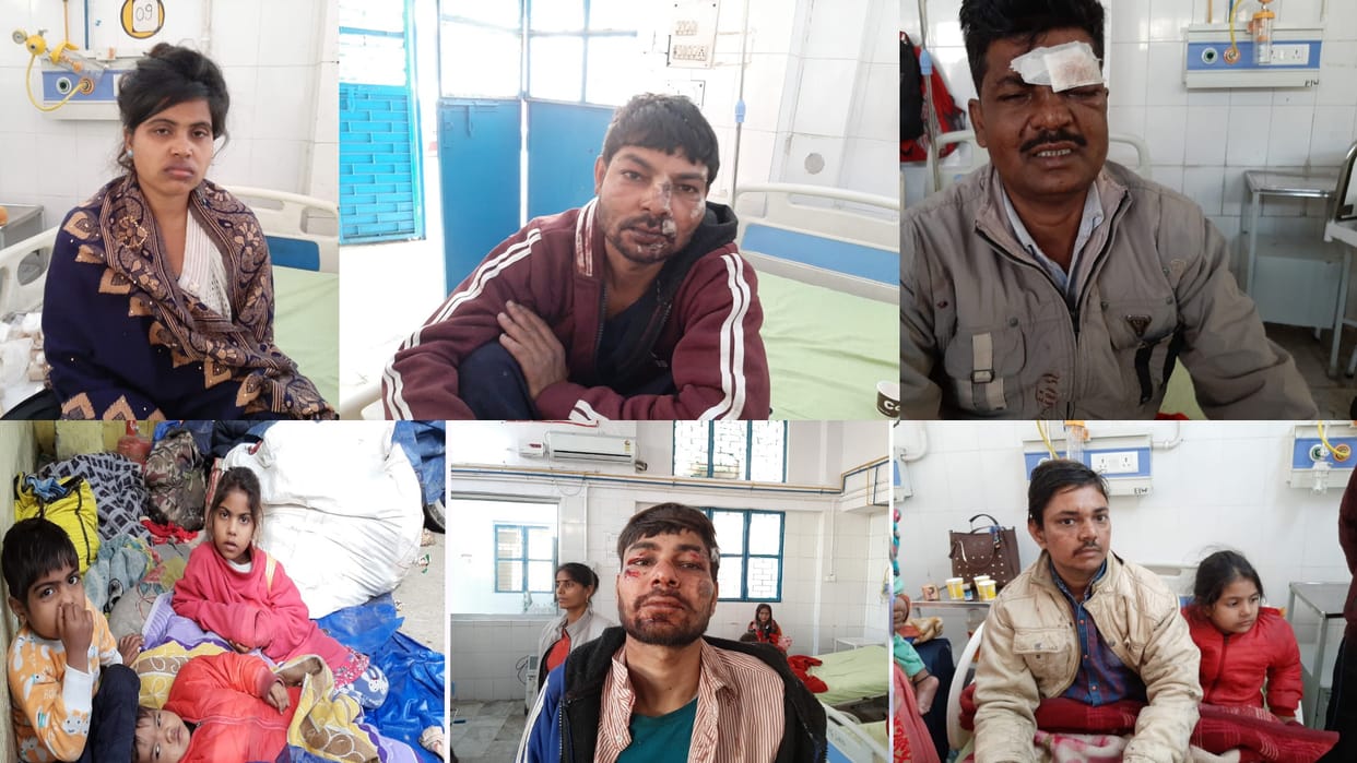 Moradabad accident pickup dcm and roadways bus collides each other on highway 20 injured cops also