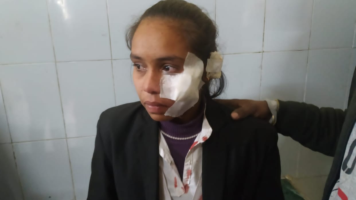 Bulandshahr man mentally unstable attack girl on face by knife for stopping him to spit