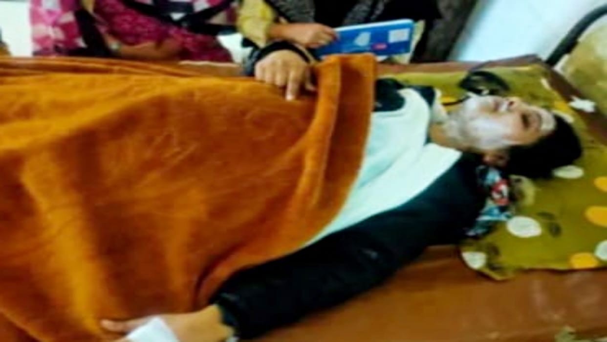 Acid thrown on younger brother's family in shop dispute