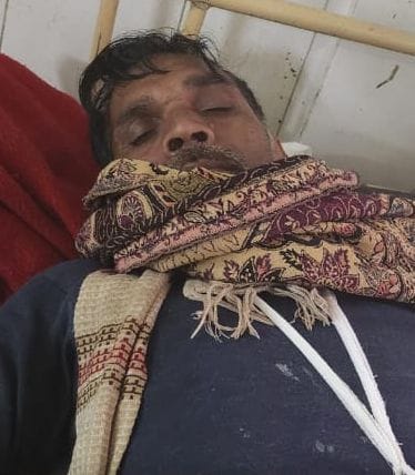 Farmer going to guard the field was shot, condition critical