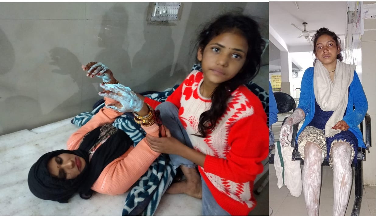 Fierce fire broke out due to leakage, seven people got serious burns