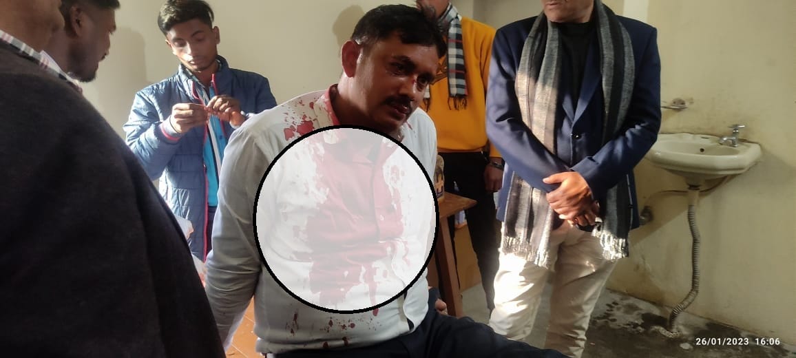 Azamgarh crime: Bike riding miscreants beat up the teacher, condition critical, referred to higher center