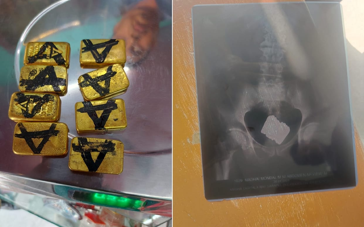 Gold Smuggling: Smuggler bringing gold hidden in body cavity, BSF arrested