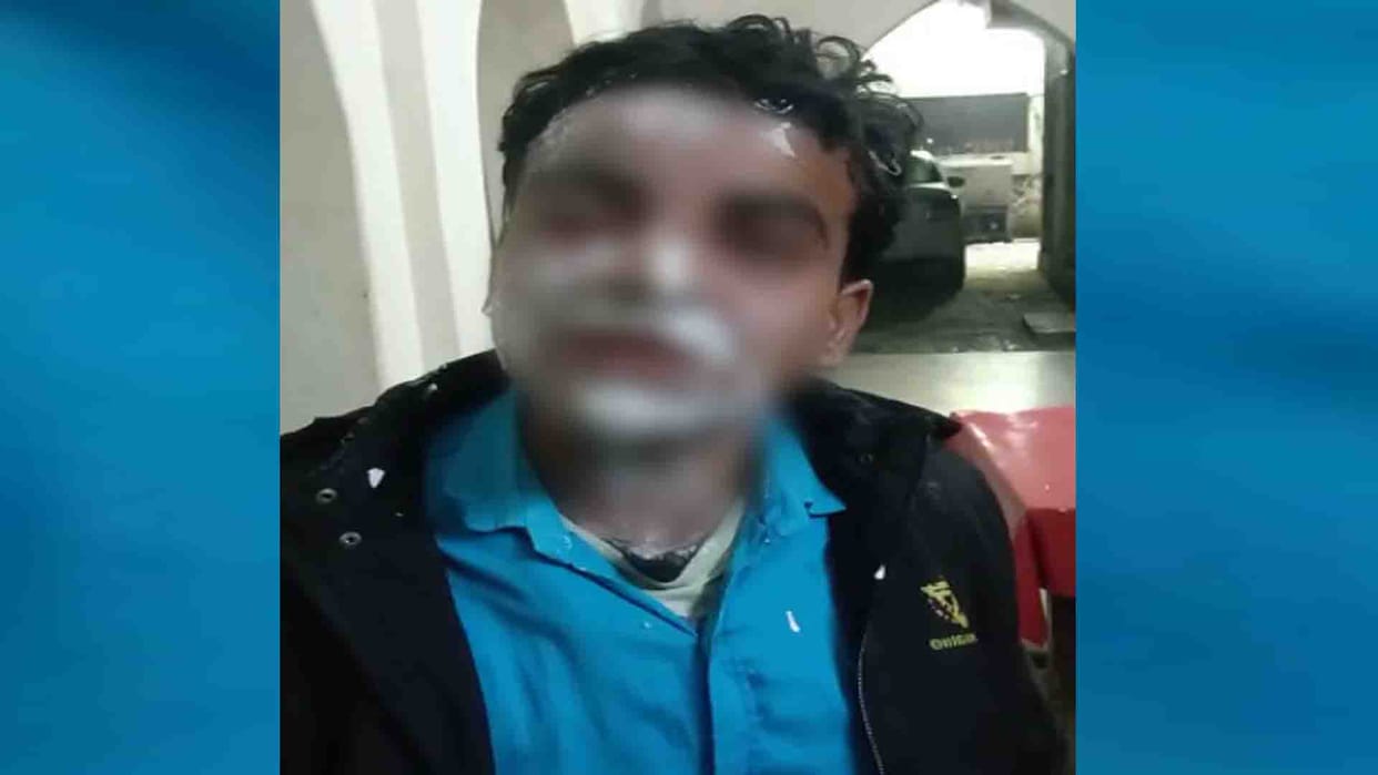New twist in case of acid attack on husband in Kanpur