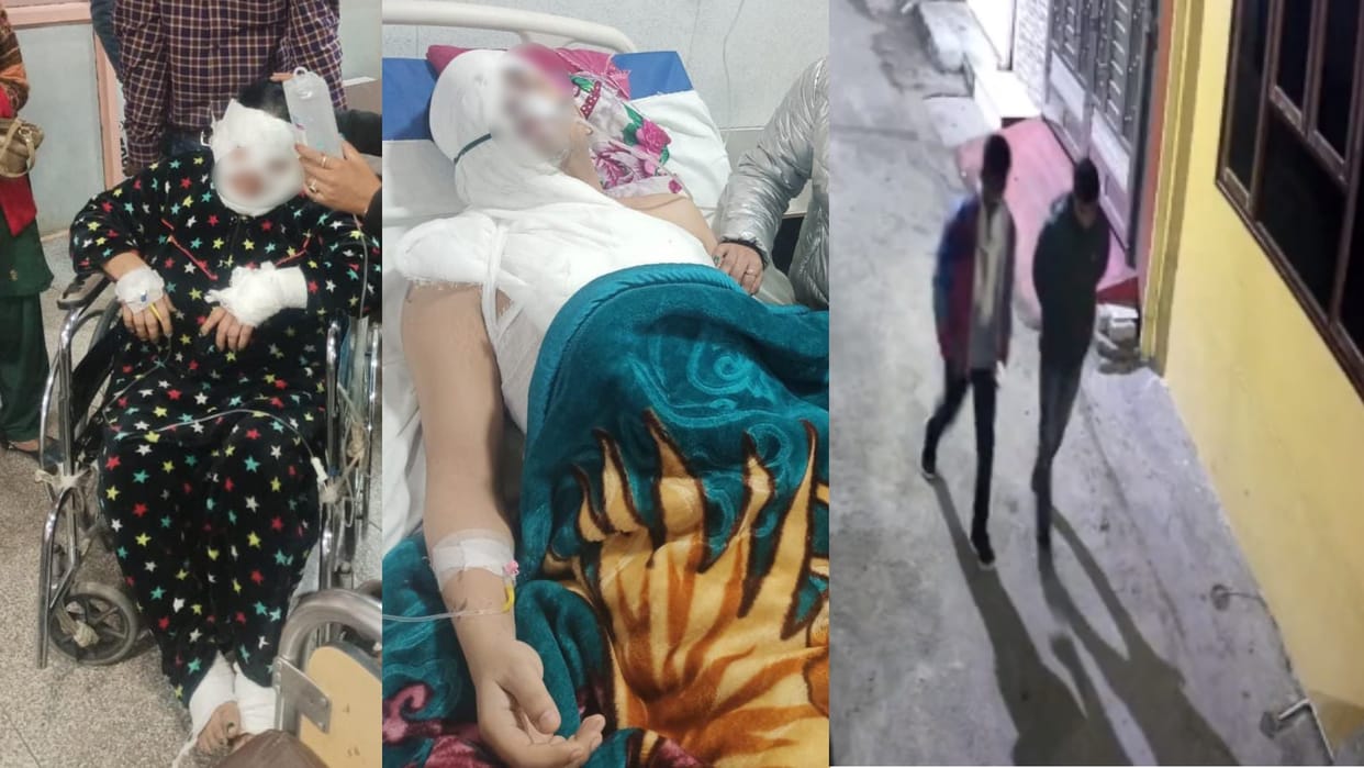 Lucknow Acid Attack Interior designer throws acid on friend and her mother for breaking gay relationship