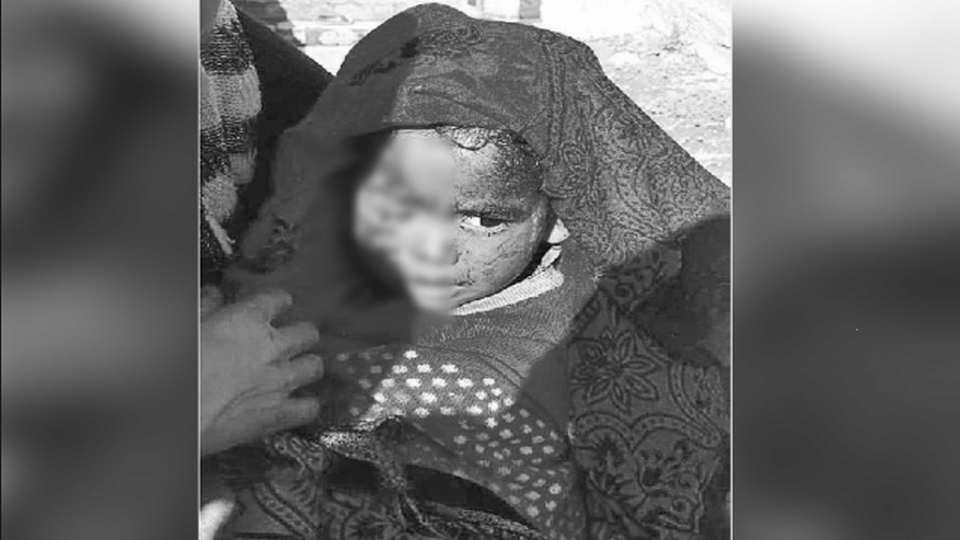 Dogs attack three year old child in Bareilly