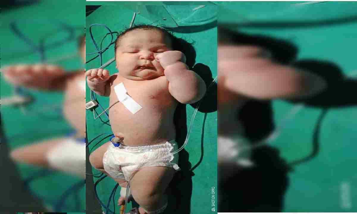 Five kg baby born doctors said weight of child is much more than normal  this is first case in Chandauli