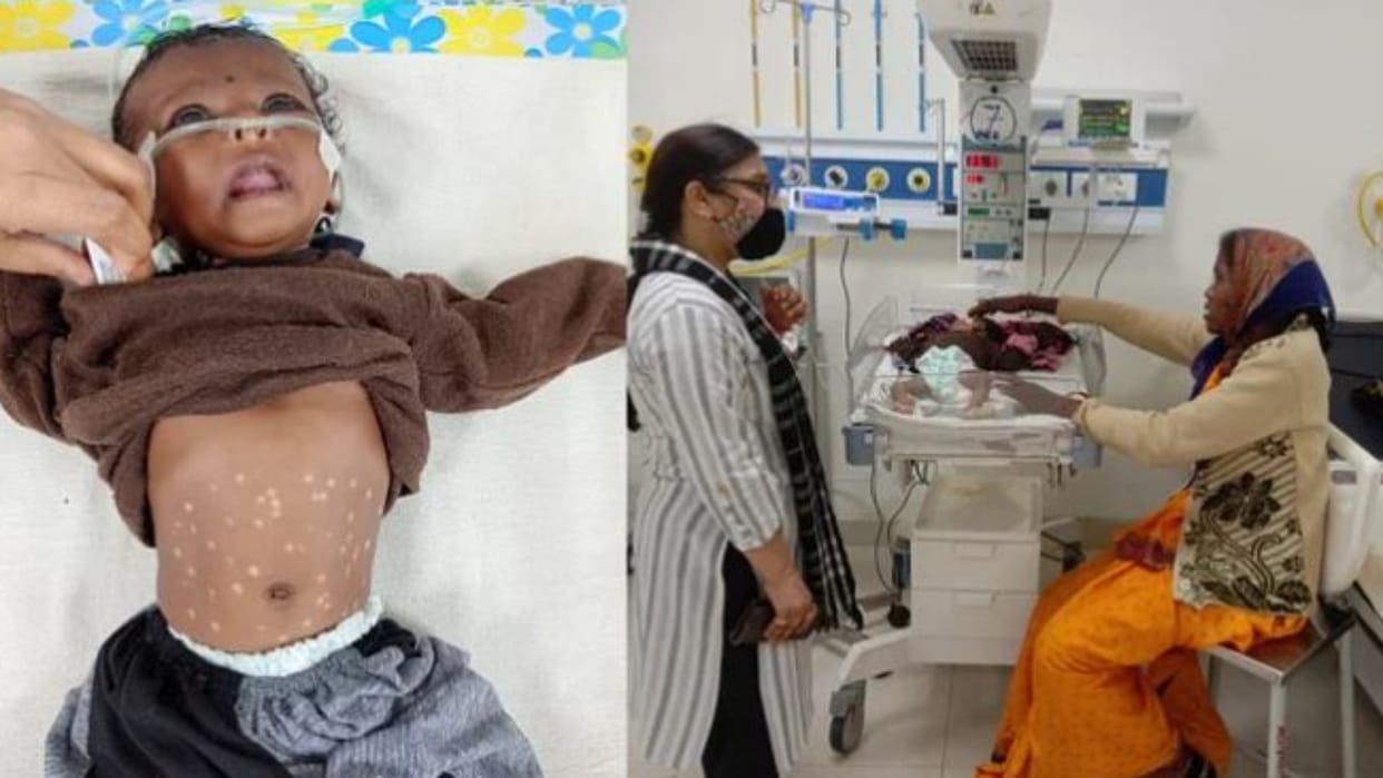 Shahdol To know the secret of death of the innocent girl dead body was removed from the grave