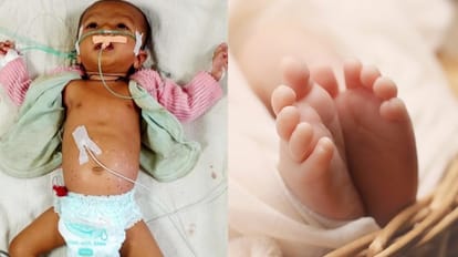 बच्ची को 24 बार गर्म सलाखों से दागा