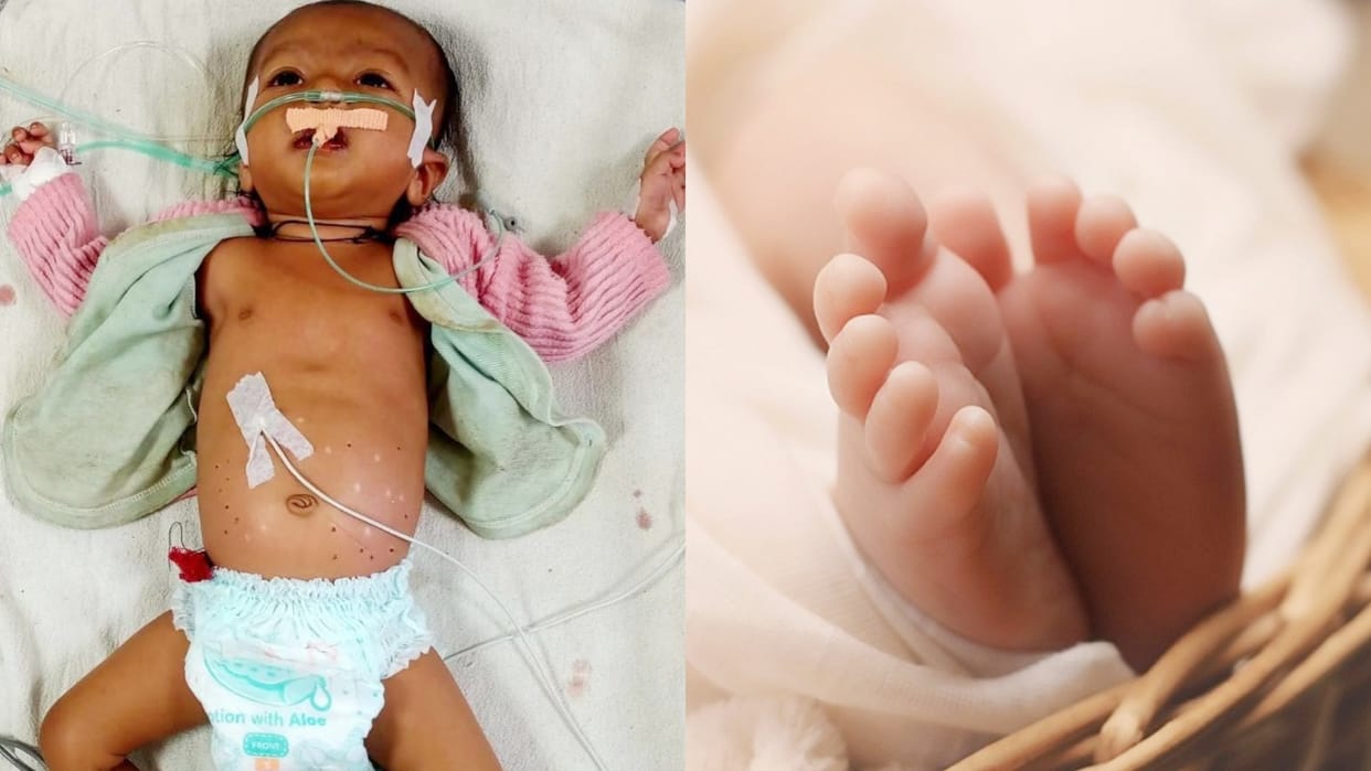 MP News another sick girl was burnt with hot rods 24 times In Shahdol
