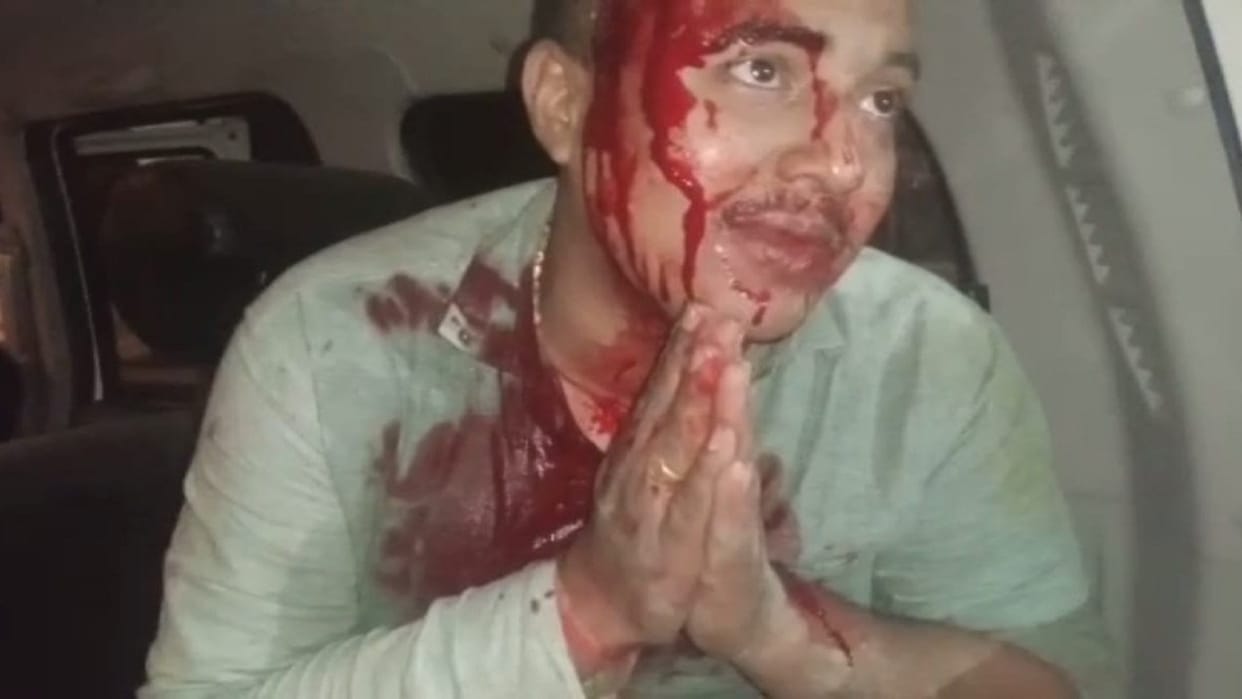 Pradhan's son was hit by Scorpio, surrounded and beaten by villagers