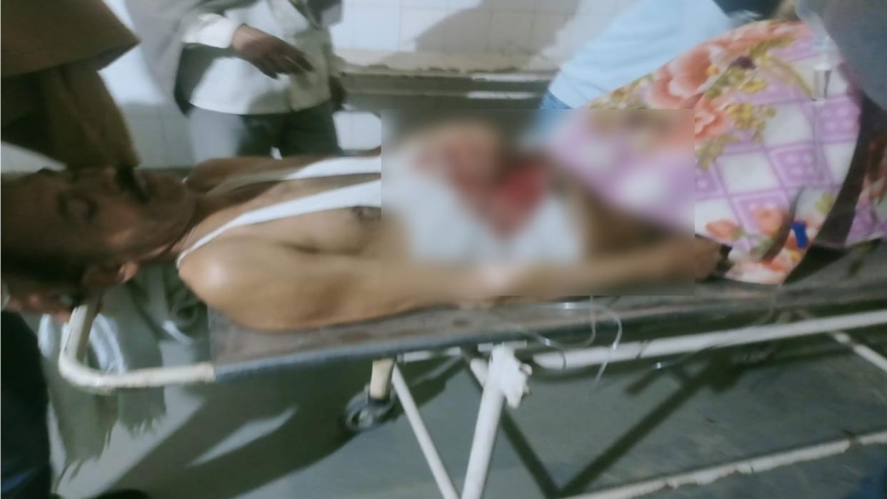 A youth shot his uncle in Baghpat, referred the injured to Meerut