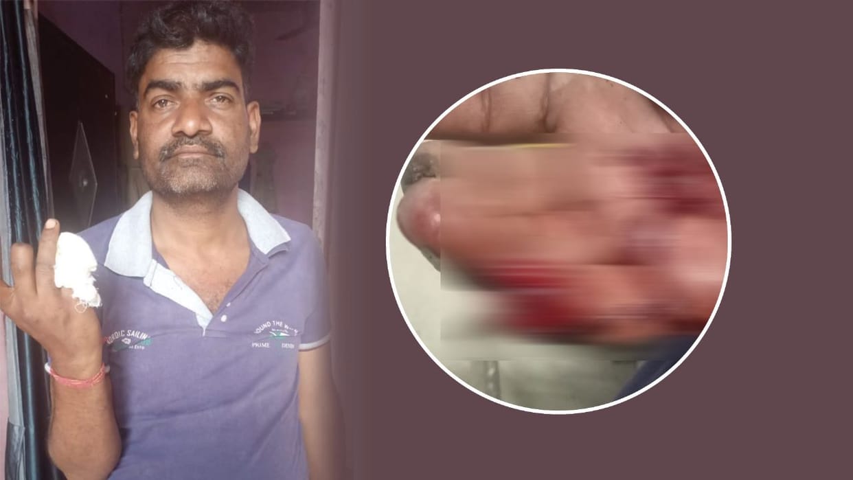 In Bhalswa Dairy area man cut off finger of another man