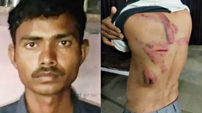 Rajasthan: रस्सी से बांधा, फिर पीट-पीटकर की मजदूर की हत्या, बर्बरता करने वालों की तलाश में जुटी पुलिस कृष्ण कुमार और घायल व्यक्ति अपने जख्म दिखाते हुए।