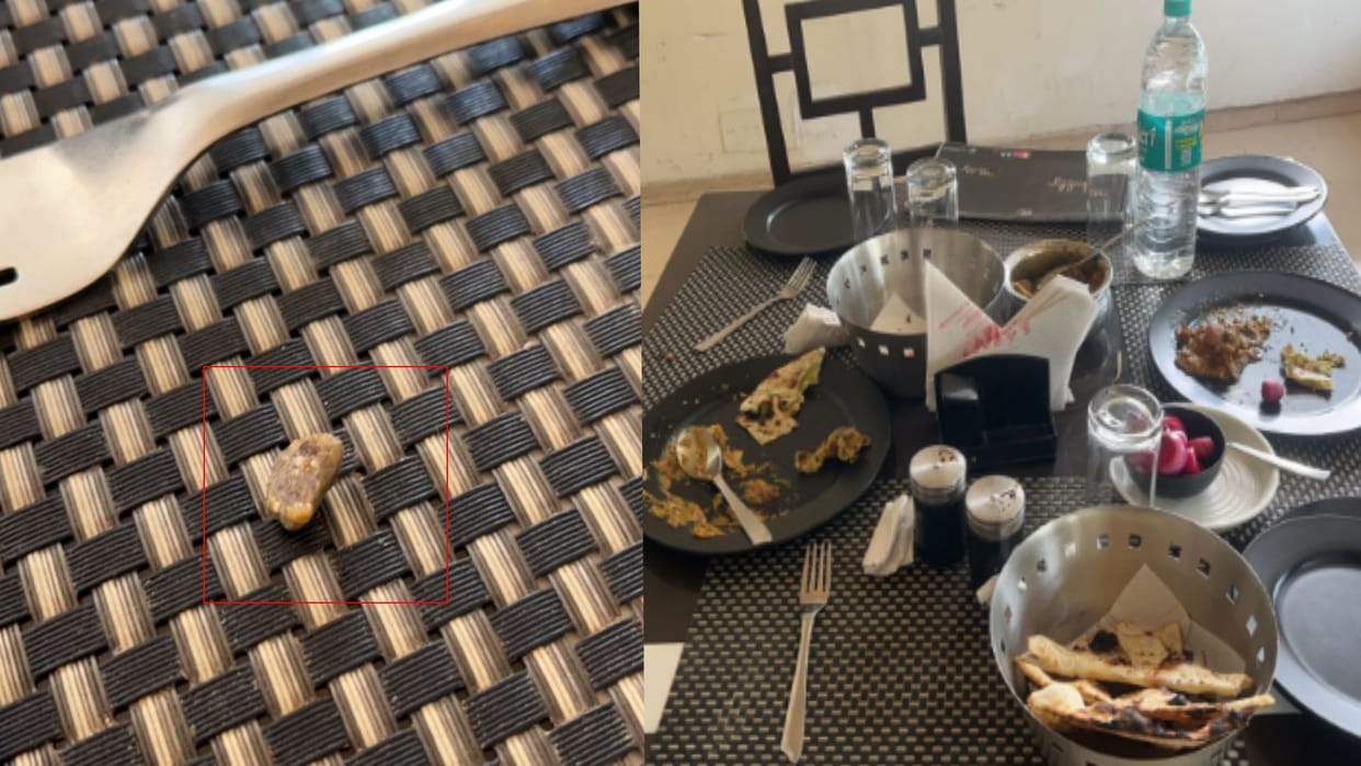 Meerut News: woman tooth broken due to pebble in the food served in a hotel