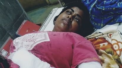 पत्नी ने केस किया तो काट दिया हाथ: ससुराल में घुसकर पति ने किया हमला, मारपीट से तंग आकर रहने लगी थी मायके में अस्पताल में भर्ती महिला।