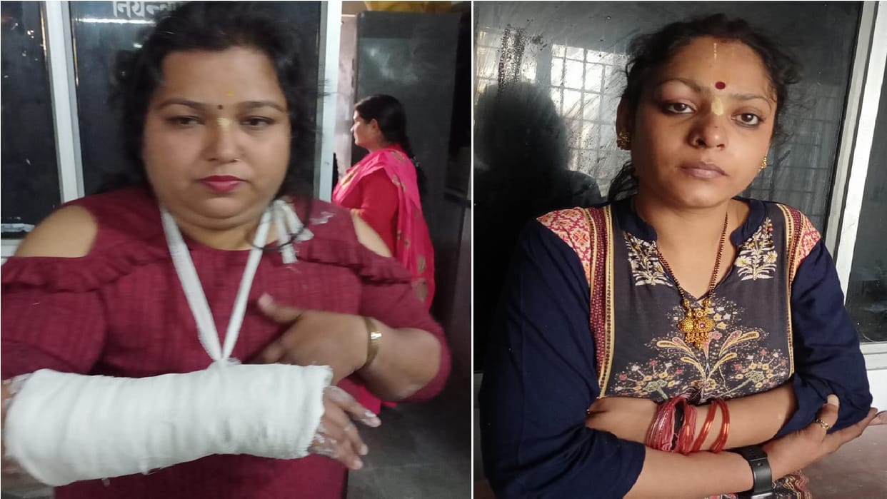 Bus of devotees going from Bageshwar to Pithoragarh overturned on road many people injured